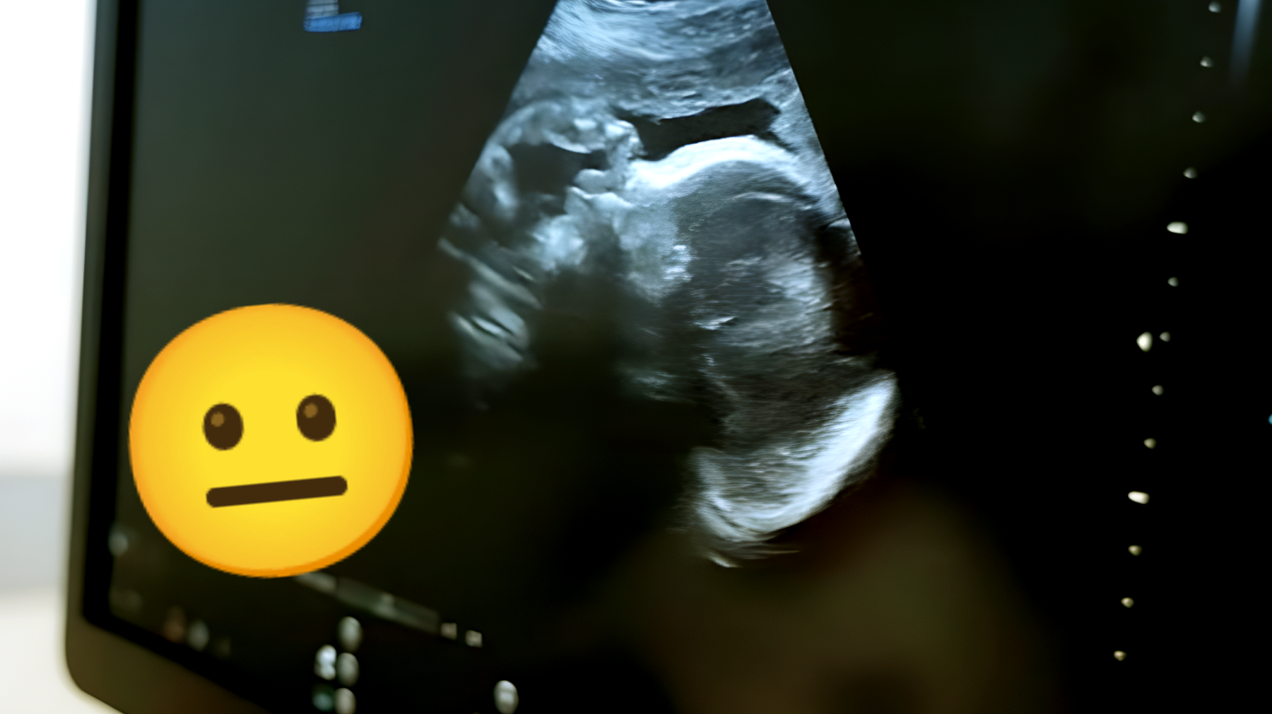 La triste scoperta di una donna incinta: "Mio marito mi ha chiesto un test di paternità"
